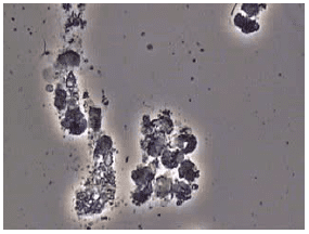 顕微鏡と薬による治療